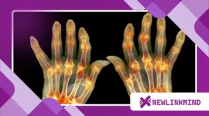 Yoga for Seniors with Arthritis: Safe and Soothing Poses